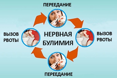 Лечение булимии в Сорочинске